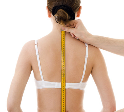 SCOLIOSIS