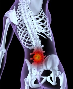 back-pain